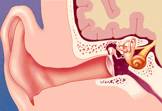 Отосклероз – это болезнь, характерным признаком которой является патологическое разрастание тканей костного лабиринта уха