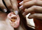 Антибиотики при хроническом отите среднего уха